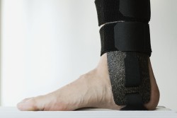 <p><em><strong>Splints used in sports: </strong>Woodcast splints are easy to form to an exact match by simply warming up the material with a hairdryer or a similar source of heat. Retouch by Flc </em></p> (photo: )